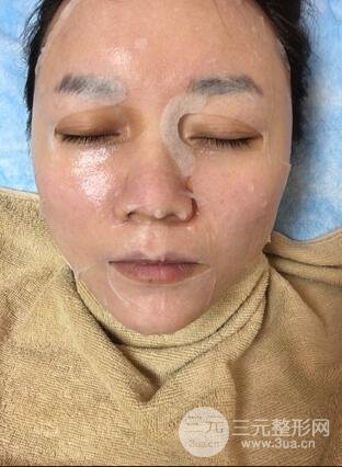 果酸换肤的果4