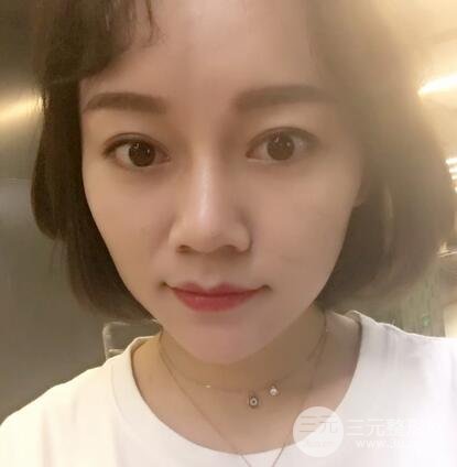 果酸换肤的果7
