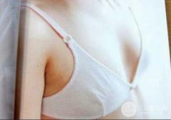 自体脂肪隆胸真实案例分享，术后C杯毫无压力~！