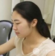 切开双眼皮|眼部上睑下垂一劳永逸的解决方法