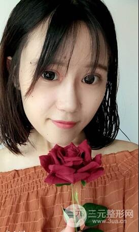 伊w兰注射隆鼻果4