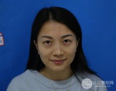 射频去眼袋多少钱？长沙美臣铂宫射频去眼袋真实案例分享~