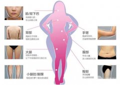 腿吸脂|吸脂项目及吸脂整形价格分享