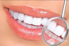 四环素牙的缓解方法|口腔美容整形项目价格分享