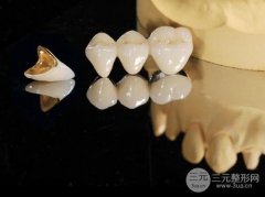 黄金烤瓷牙的价格|牙齿整形美容项目价格分享