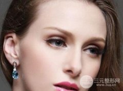 什么是开眼角手术 开眼角手术多少钱