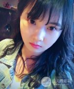 广州吉汀假体垫下巴|下巴整形假体植入填充一个月恢复果