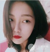 北京悦丽汇|全切双眼皮眼部一周术后恢复果