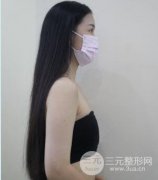 武汉珍妮胸部整形|自体脂肪隆胸填充塑造迷人性感身材