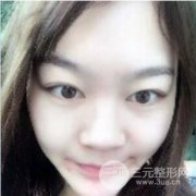 成都青羊昆贝拉隆鼻整形|鼻部整形项目价格分享 成都青羊昆贝拉隆鼻整形|鼻部整形项目价格分享