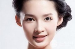 内切去眼袋多久恢复 术前需要注意什么