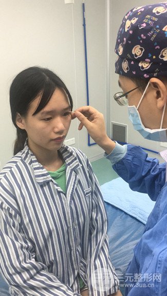 广州健丽整形价格表|不开刀双眼皮前后对比图分享