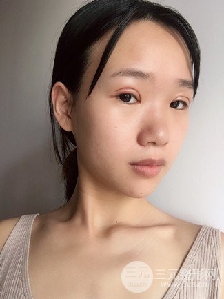 广州健丽整形价格表|不开刀双眼皮前后对比图分享