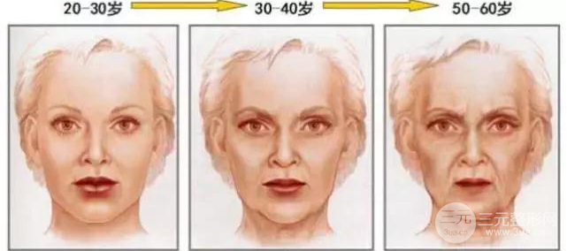 面部埋埋提升好不好?一根线拉开“女神”与“女婶”的距离