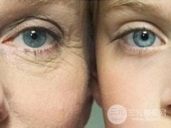 缓解鱼尾纹的方法