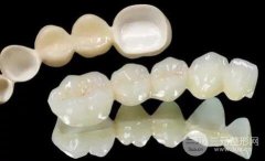 一口烤瓷牙多少钱