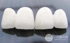 钛合金烤瓷牙好吗|钛合金烤瓷牙多少钱