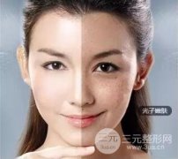 光子嫩肤大概需要多少钱？附IPL嫩肤案例果对比图片分享~
