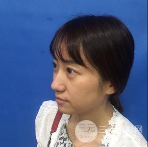 缓解鱼尾纹的方法2