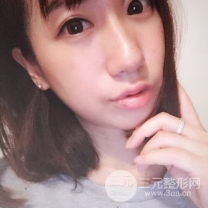 缓解鱼尾纹的方法8