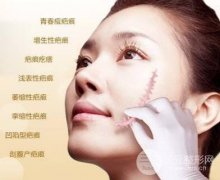 去除手术疤痕的方法 价格贵不贵