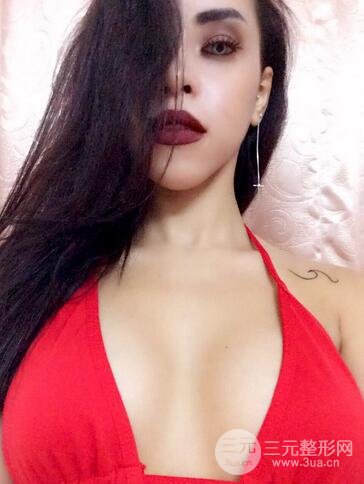 娜高假体隆胸多少钱5