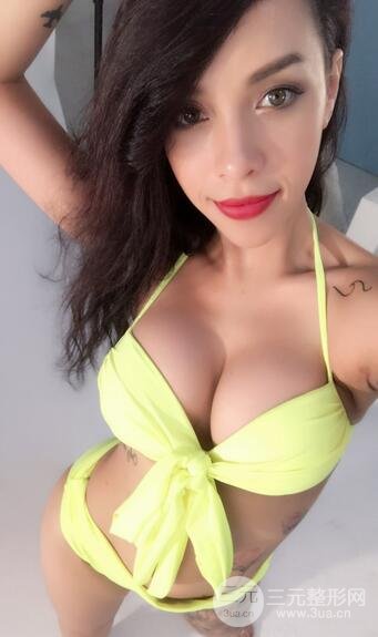 娜高假体隆胸多少钱8