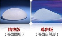 曼托假体隆胸果怎么样  价格贵不贵