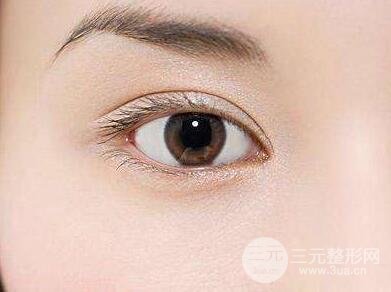 生物焊接双眼皮手术怎么样价格合理不