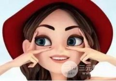 焊接双眼皮是什么？果能管多久？附案例图片果分享~