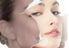 解析:彩光嫩肤要多少钱？功和果维持的时间大揭秘