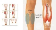 注射瘦腿多少钱一针？打几次能保持永.久？附真实案例图片