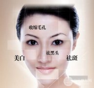 做光子嫩肤的价格  光子嫩肤果好不好