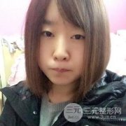 上海九院割双眼皮找谁？割双眼皮案例7天详细恢复过程照片真人分享