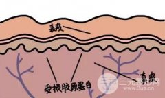 光子嫩肤几次才有？缓解过程怎样的？家用光子嫩肤仪有用吗？