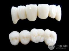 成都全烤瓷牙价格，多少钱