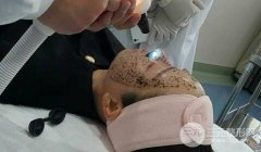 黑脸娃娃有用吗？可以缓解皮肤的哪些问题呢？