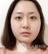 B****前后对比图 内附真实案例