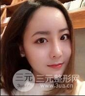 B****手术