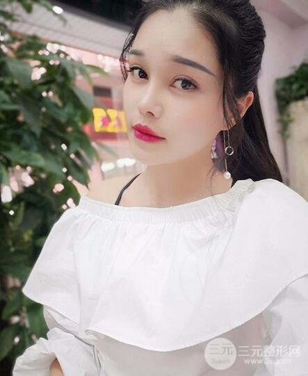 鼻头缩小术过程图，鼻头缩小恢复日记