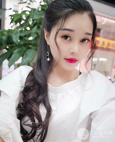 鼻头缩小术过程图，鼻头缩小恢复日记