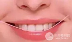 做美容冠多少钱