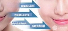 黑脸娃娃的功有哪些