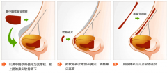 垫高鼻梁多少钱 价格贵不贵 垫高鼻梁多少钱 价格贵不贵