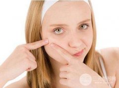 光子嫩肤的果如何？需要几次缓解？有哪些功？