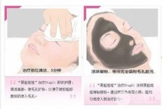 黑脸娃娃有什么作用？什么是黑脸娃娃美容？