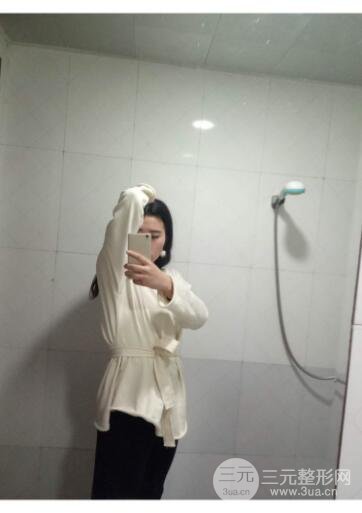 环形腰部吸脂案例