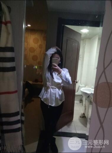 环形腰部吸脂案例