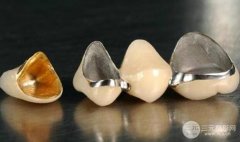 假牙的坏处?假牙的危害有哪些?