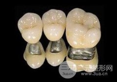 烤瓷牙变黑怎么办?